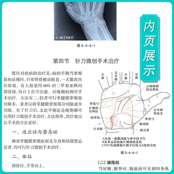 Фундаментална и клинична акупотомия-Заболявания на костите и ставите, Субобъемная травма на мускулите, притискане на периферните нерви (китайското издание) Твърди корици